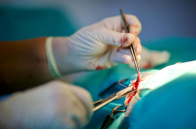 Chirurgie & hospitalisation 